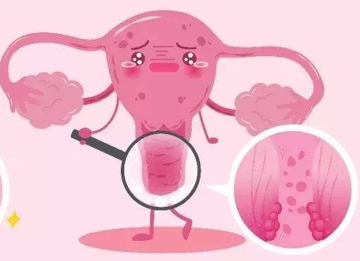 白帶常規草莓视频污新地址廠家提醒女士做好私密處清洗