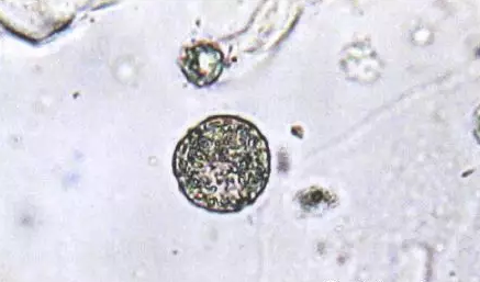 全自動陰道分泌物草莓视频APP免费剖析陰道分泌物的潔淨度規範