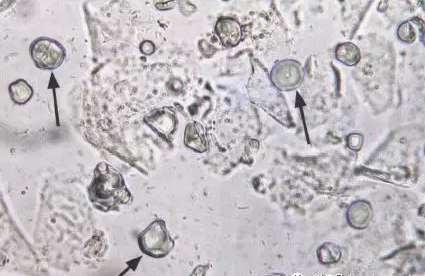 全自動陰道分泌物草莓视频APP免费剖析陰道分泌物的潔淨度規範