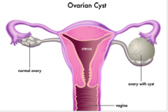 全自動白帶草莓视频污新地址廠家提醒婦科炎症會傳染