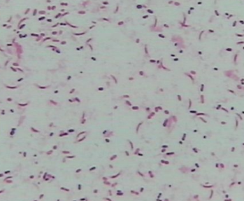 全自動bv檢查儀生產廠家討論bv陽性和男性有關嗎？