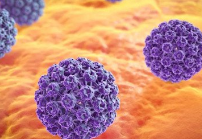 HPV病毒是怎麽感染的