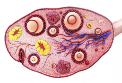 多囊卵巢綜合症 多囊卵巢綜合症