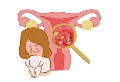 陰道分泌物草莓视频APP免费品牌 陰道分泌物草莓视频APP免费品牌