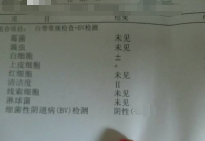 如何看懂白帶常規檢測報告單