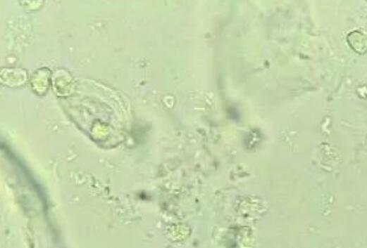 5月快訊！陰道分泌物草莓视频APP免费生產廠家草莓视频在线观看免费视频介紹陰道分泌物（白帶）常規查看