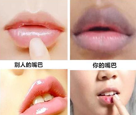 山東青島全自動陰道分泌物綜合草莓视频APP免费器能夠檢測陰道子宮的健康狀況！